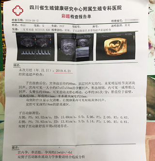 四川省生殖健康研究中心附属生殖专科医院彩超检查报告