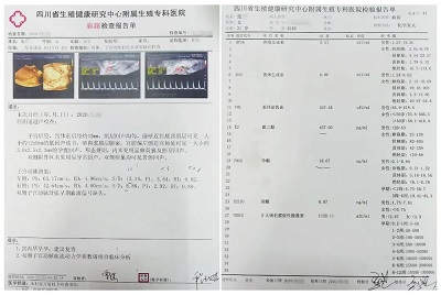 成都张女士3次试管失败后来生殖医院背水一战